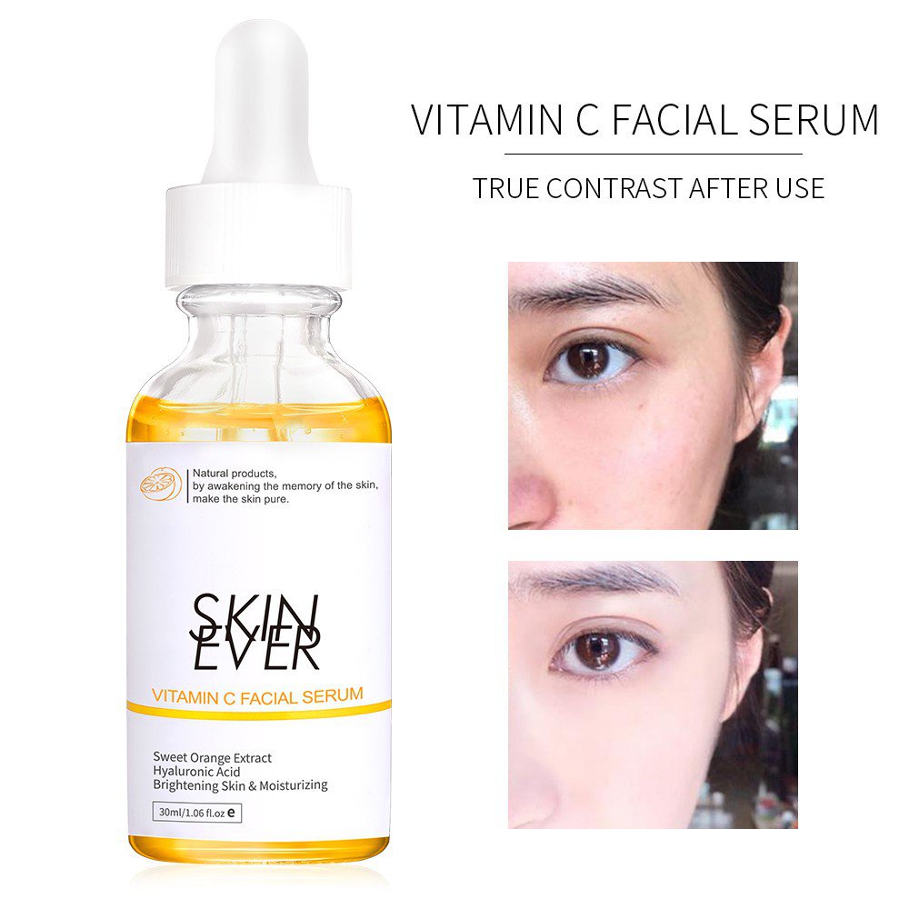Beauty Shop Serum SKIN EVER chiết xuất cây trà/ nho biển giữ ẩm/ rau má/ cà phê loại bỏ quầng thâm 30ml