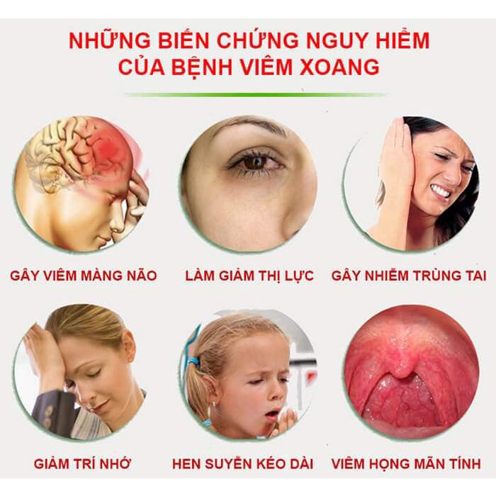 Dung dịch xịt mũi họng Dr Hương -Thanh Mộc Hương 15ml