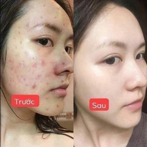 Serum Caramel essence  của Viện Da Liễu tại Spa
