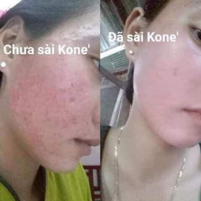 Kem Facial Cream Kone Thái Lan | BigBuy360 - bigbuy360.vn