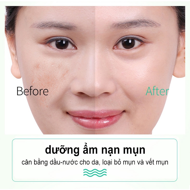 Gel nha đam Dưỡng ẩm Chống lão hoá Trị mụn trứng cá Mờ sẹo Gel chống nắng 40g Dịu nhẹ không kích ứng