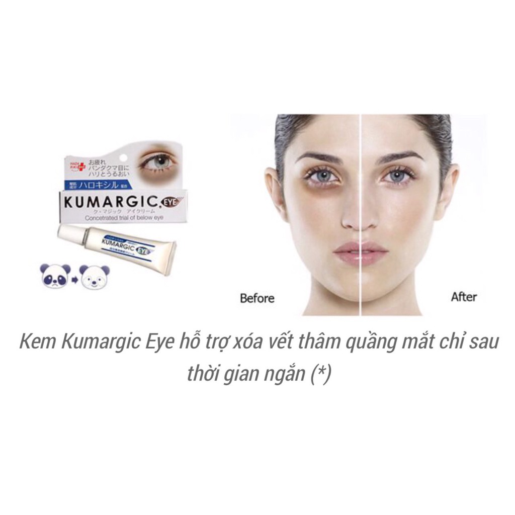 Kem THÂM QUẦNG MẮT Kumargic Eye Nhật Bản 20g mờ thâm quầng mắt, bọng mắt, giảm nếp nhăn, vết chân chim | BigBuy360 - bigbuy360.vn