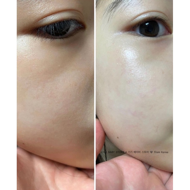 Kem dưỡng ẩm đa năng làm dịu mát da ATOPALM SOOTHING GEL LOTION 120ml cho trẻ sơ sinh, trẻ em, người lớn