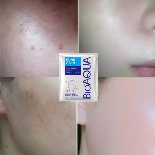 Mặt nạ mask Pure Skin Bioaqua nội địa Trung | BigBuy360 - bigbuy360.vn