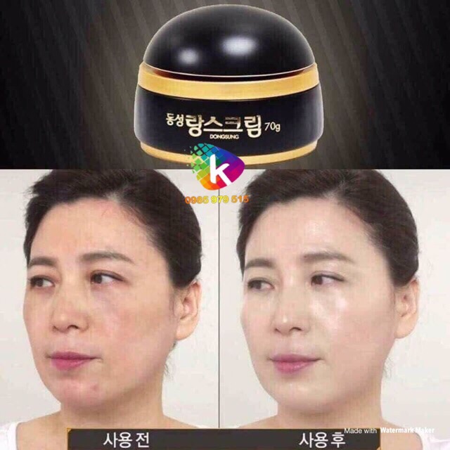 (Đủ Bill) Kem dưỡng trắng da hỗ trợ mờ nám Dongsung Rannce Cream | BigBuy360 - bigbuy360.vn