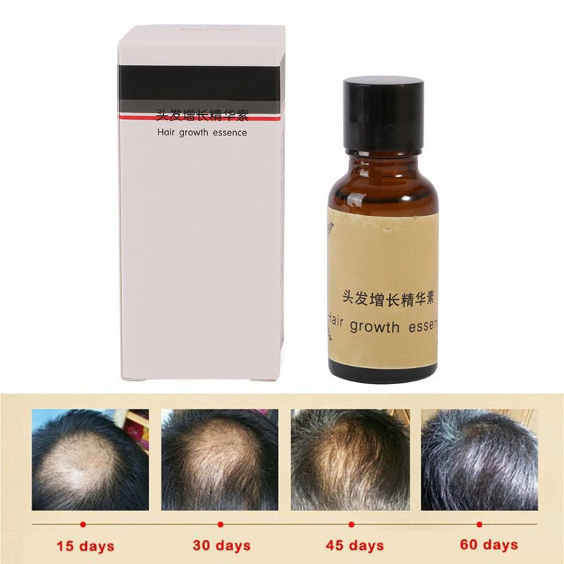 Tinh chất hỗ trợ mọc tóc chống rụng 20ml