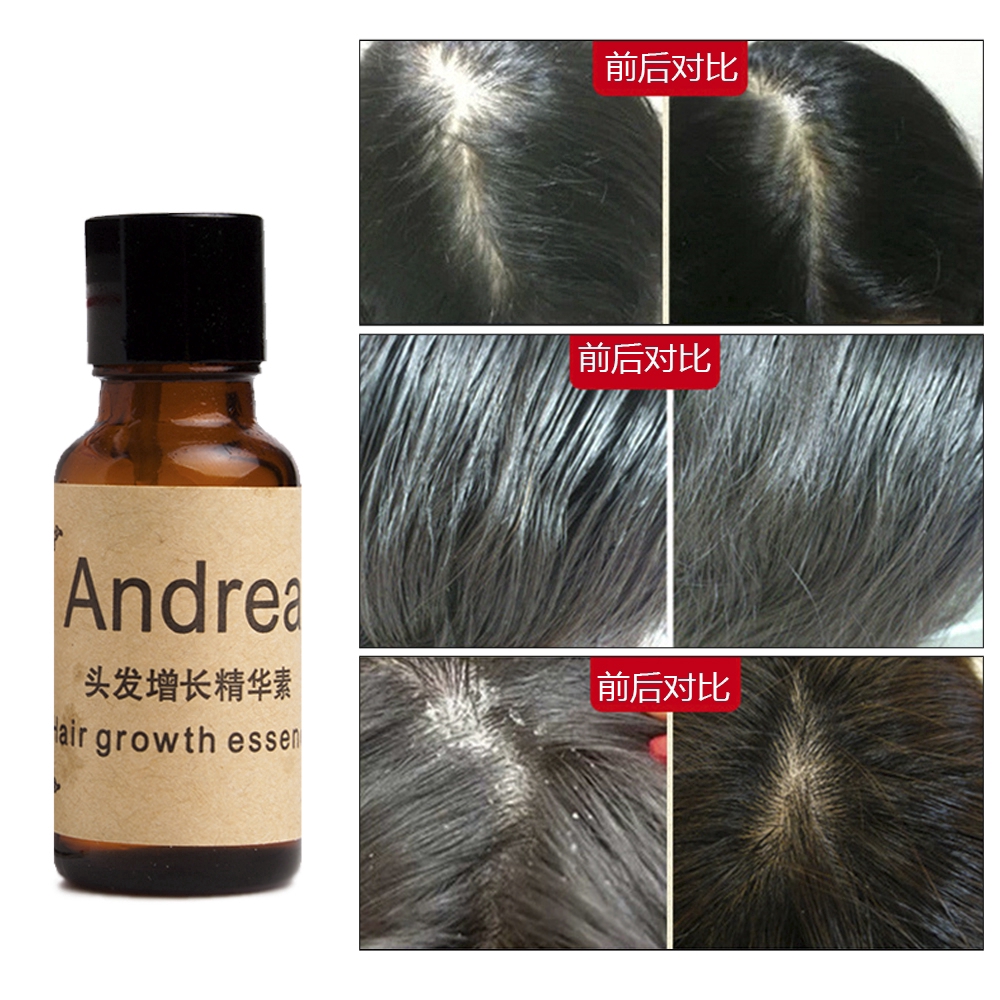 [Hàng mới về] Huyết thanh tinh chất thực vật tự nhiên Andrea kích thích mọc tóc và chống rụng tóc 20ml
