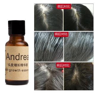 [Hàng mới về] Tinh Chất Kích Thích Mọc Tóc Andrea Thể Tích 20ml