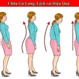 Đai chống gù lưng