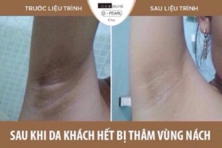 Kem dưỡng da Q – Pearl
