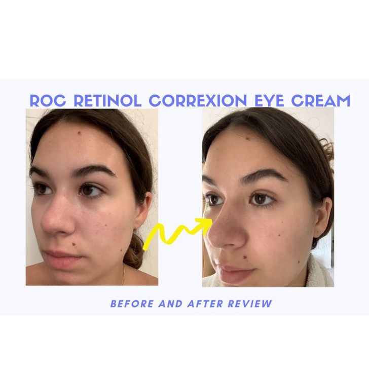 ROC Kem Dưỡng Vùng Mắt Retinol Correction Line Smoothing Eye Cream 15ml