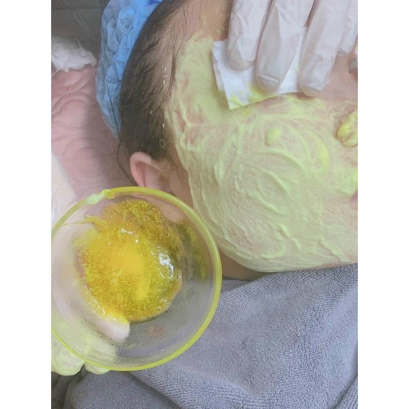 Mặt nạ thải độc - Detox nghệ sủi bọt thải độc cho da