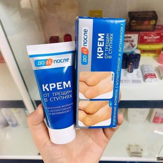 [ Hàng Chính Hãng] Kem Nứt Gót Chân Kpem Nga 50ml