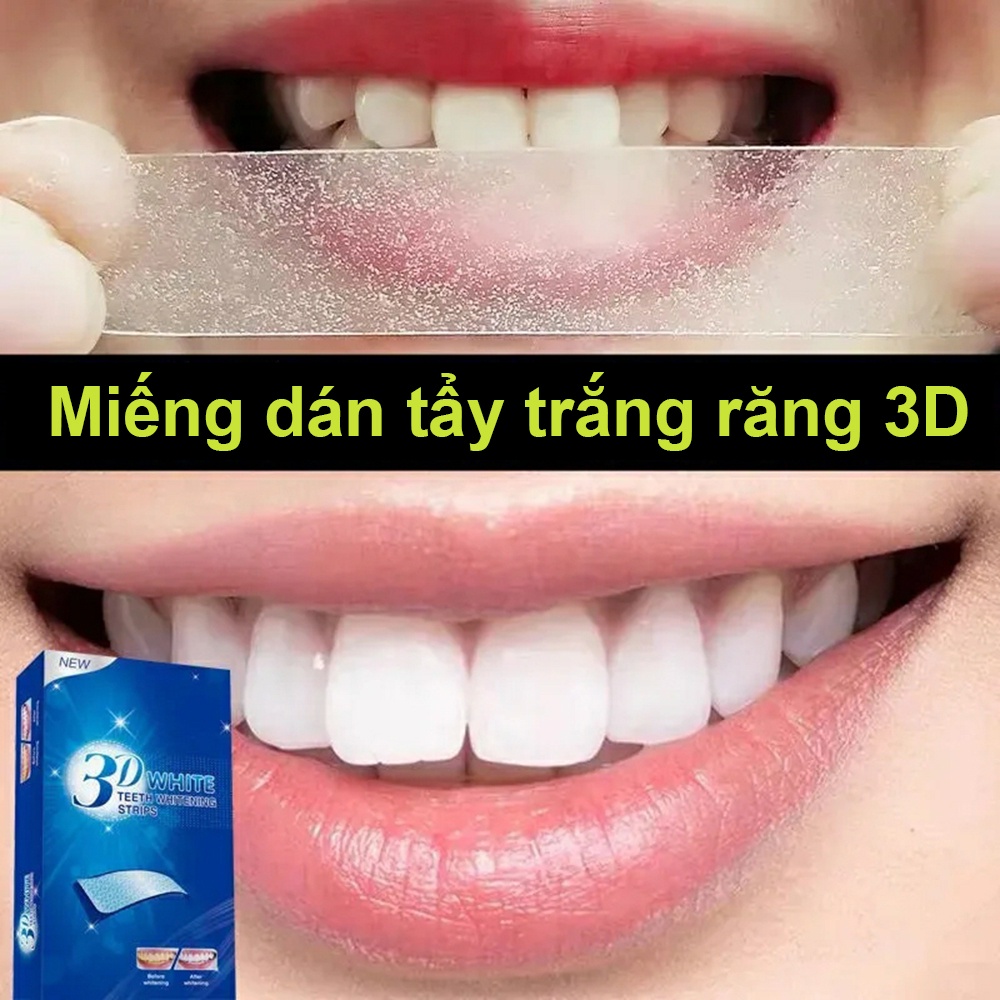 Miếng dán trắng răng tiện lợi 3D White Teeth Whitening Strips gồm 14 miếng dán 7 gói