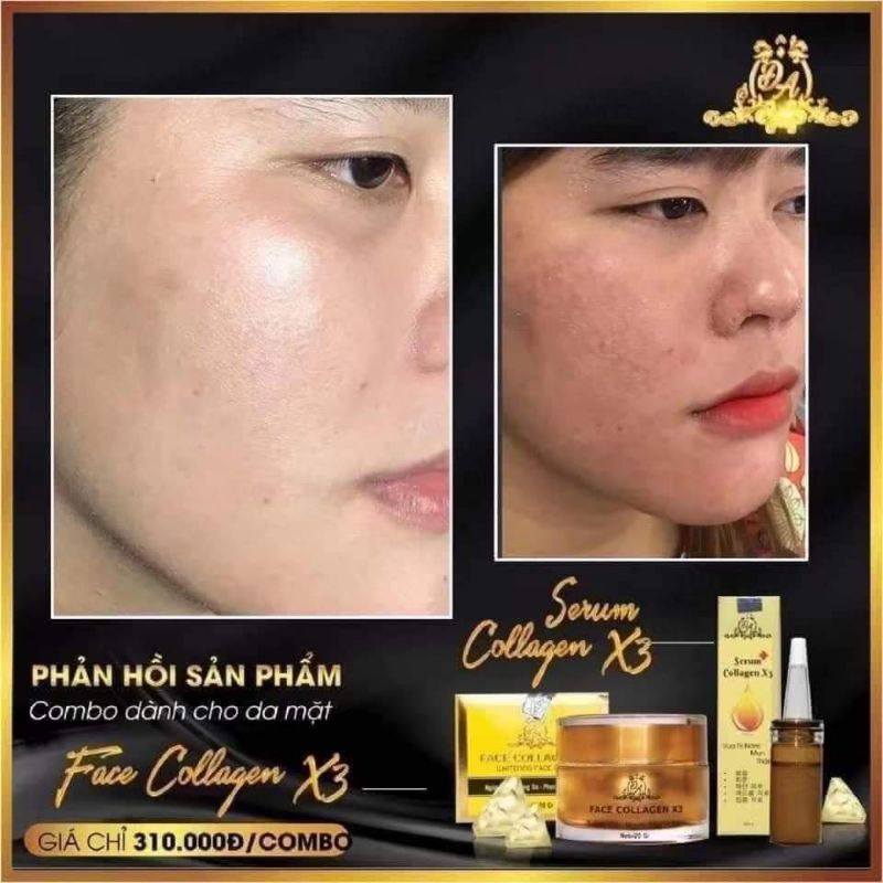 FACE COLLAGEN X3 TRẮNG DA NGỪA THÂM NÁM, MP ĐÔNG ANH CHÍNH HÃNG | BigBuy360 - bigbuy360.vn