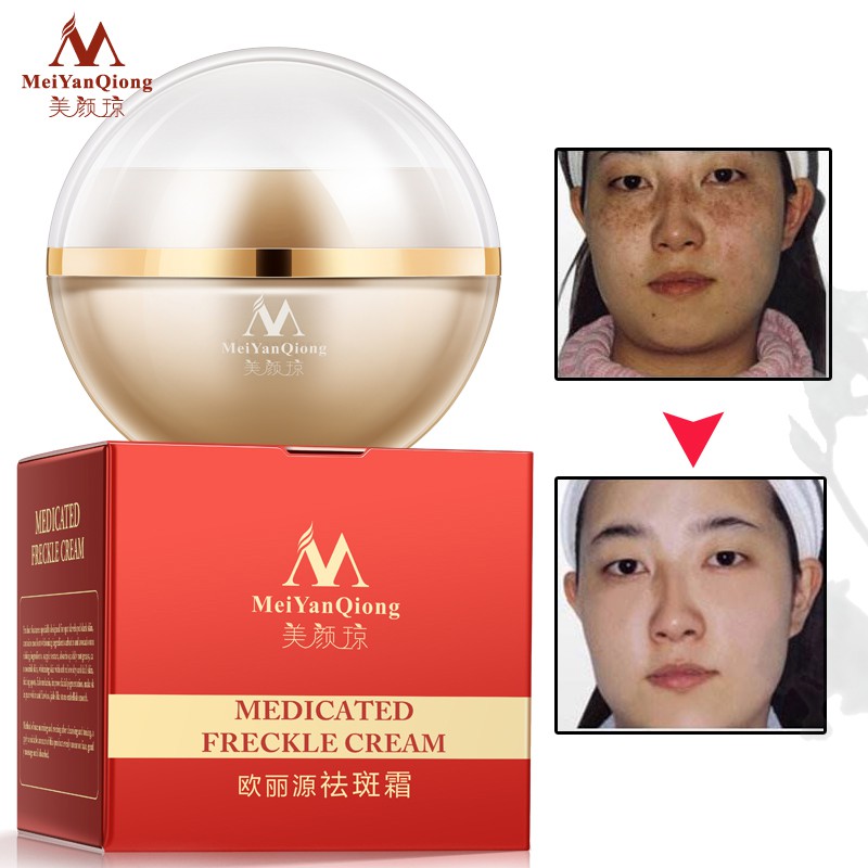 Set 2 kem dưỡng trắng MeiYanQiong chống lão hóa dưỡng ẩm 60g