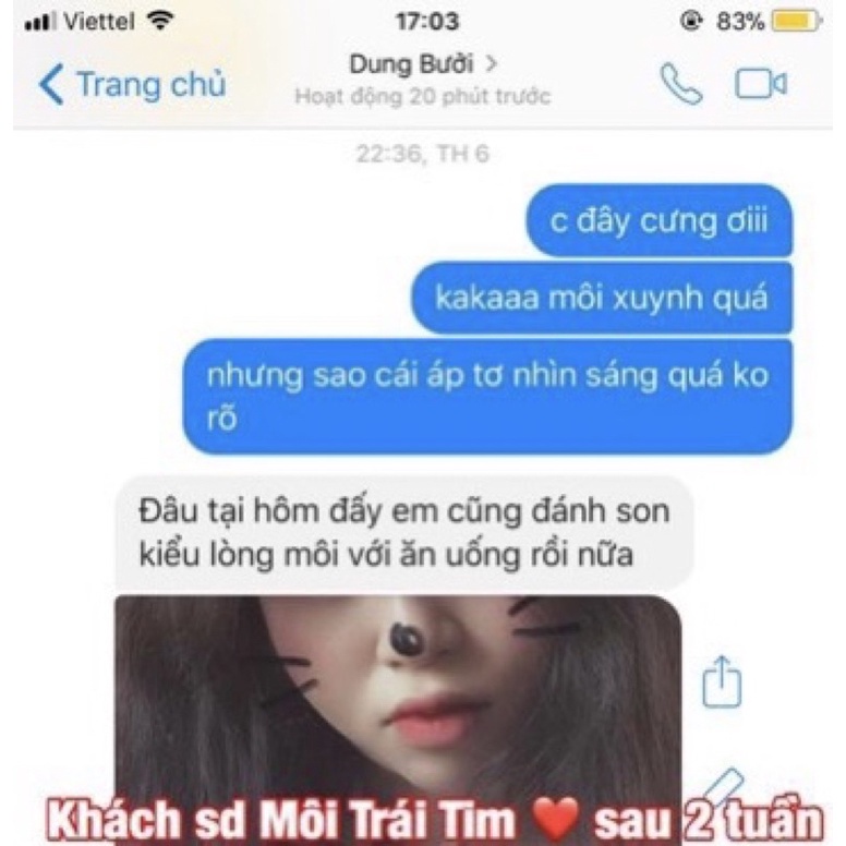Tinh chất Miracle Pháp tạo môi trái tim và làm dầy môi sexy (10ml)