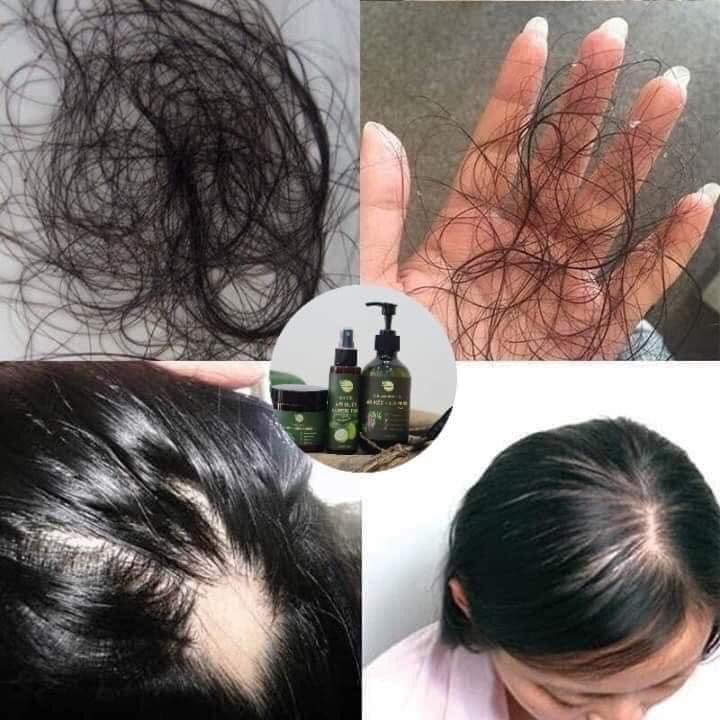 Dầu gội bồ kết lá bưởi - tóc đẹp chuẩn salon với dầu gội dược liệu từ thiên nhiên 100%- an toàn cho cả mẹ và bé