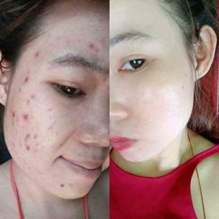 Kem Face White skin cream