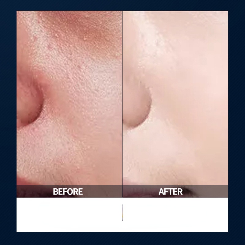 Kem Nền Che Khuyết Điểm Chống Thấm Nước Và Mồ Hôi Kiểm Soát Dầu Cho Nam