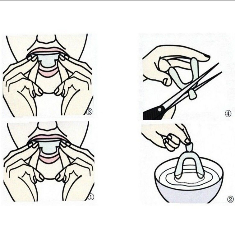 4 Miếng Silicone Bảo Vệ Răng Khi Ngủ