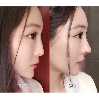 Bộ dụng cụ nâng mũi 3D Hàn Quốc