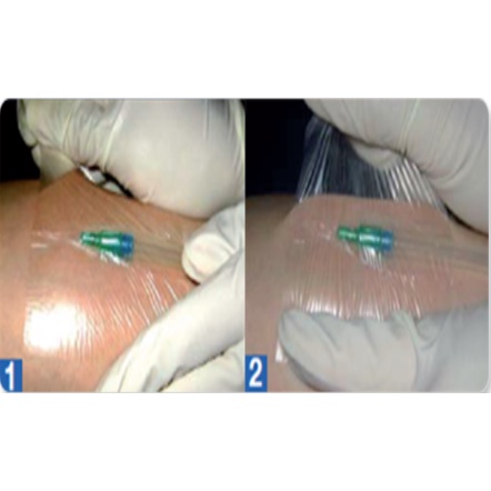 Gạc film trong suốt có keo dính giúp cố định gạc,bảo vệ hình xăm, chống nước Hetis Film  HTF