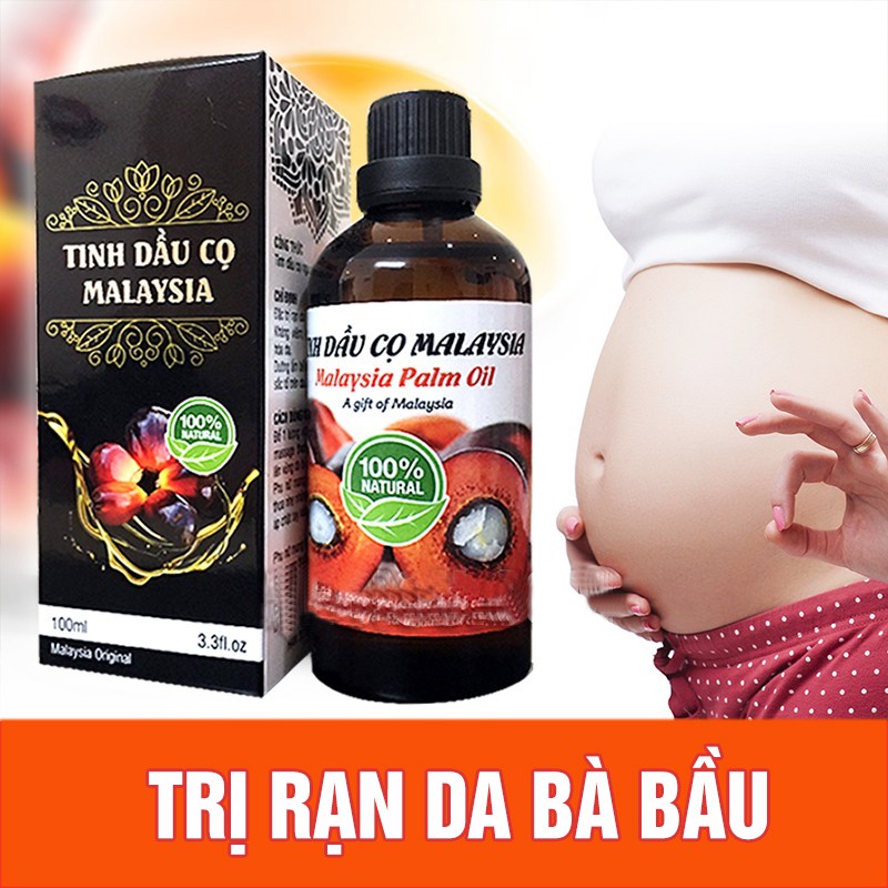 Tinh dầu cọ trị rạn da Malaysia 100ml