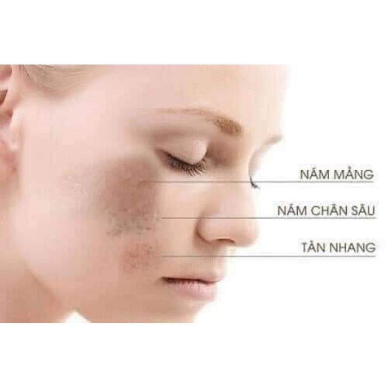 Kem Dưỡng Mờ Nám Kobayashi Ex Premium Nhật Bản