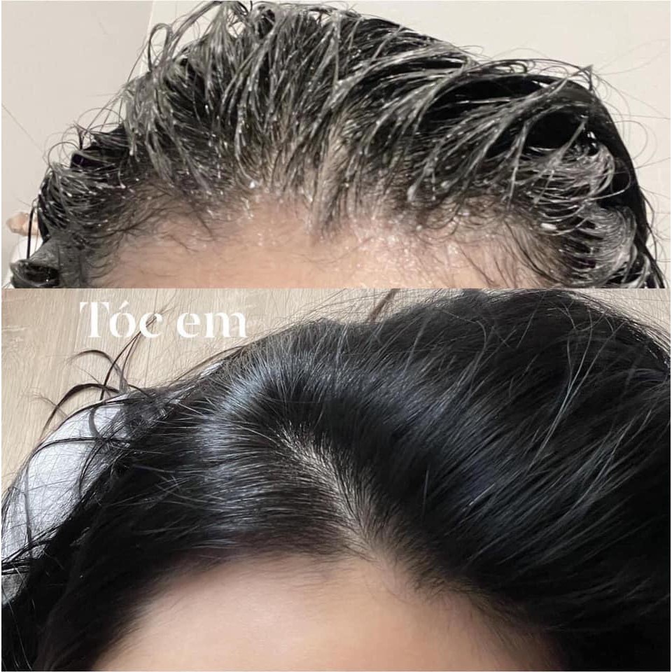 Tẩy da chết da đầu JIORNIEE kiểm soát dầu nhờn giảm bết tóc làm sạch chăm sóc tóc tại nhà