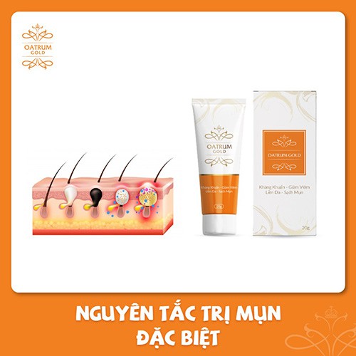 Oatrum Gold - Kháng Khuẩn, Giảm Viêm, Liền Da, Sạch Mụn, Giảm Mụn Viêm, Mụn Sưng Đỏ, Dịu Nhẹ Da, Sạch