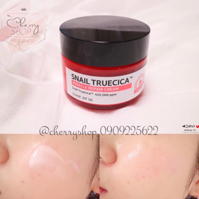 Bộ dưỡng da ốc sên Some By Mi Snail Truecica Miracle Repair Starter Kit