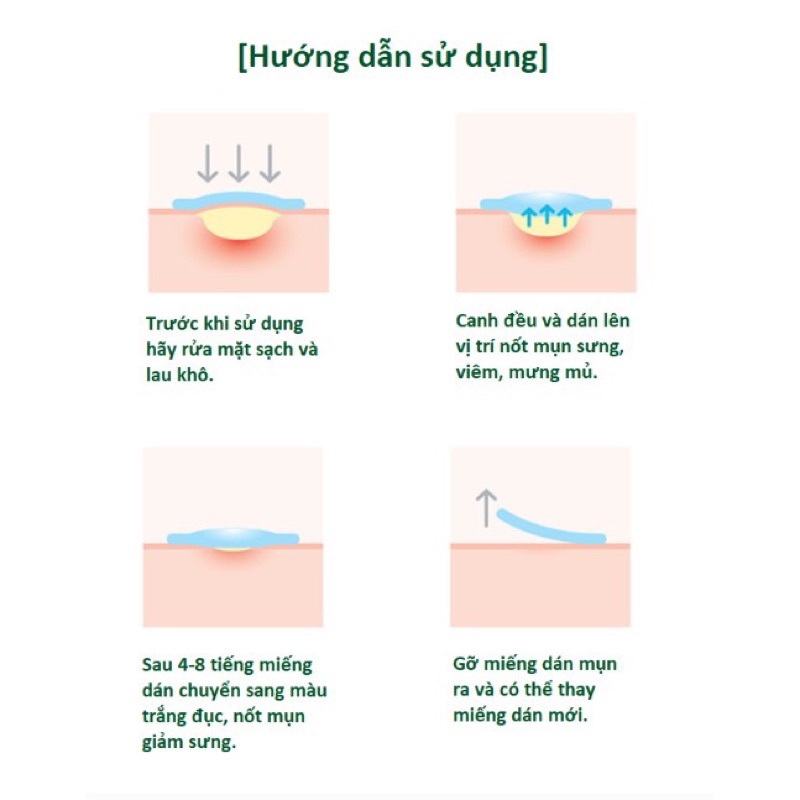 Miếng dán giảm mụn SOME BY MI SPOT PATCH