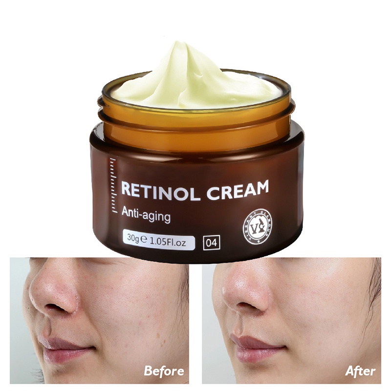 Kem retinol COCUTE dưỡng trắng chống lão hóa 30g