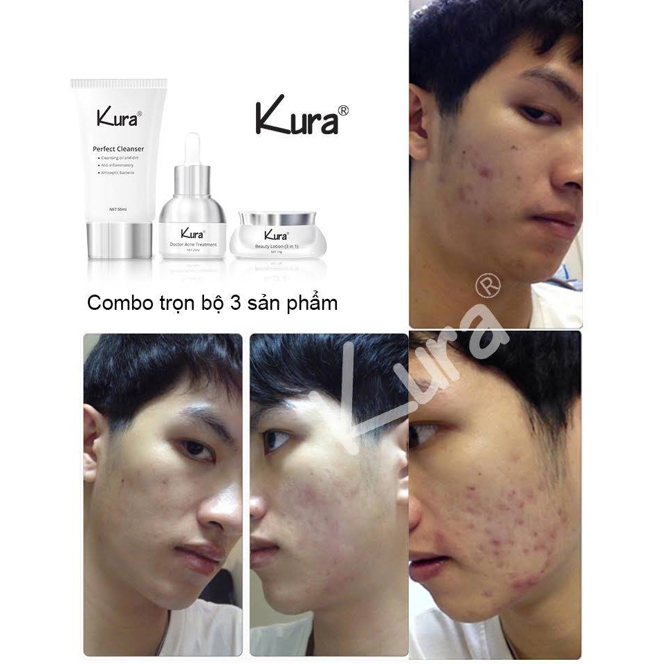 Sữa Rửa Mặt Cao Cấp - Kura Perfect Cleanser 50 ML | BigBuy360 - bigbuy360.vn