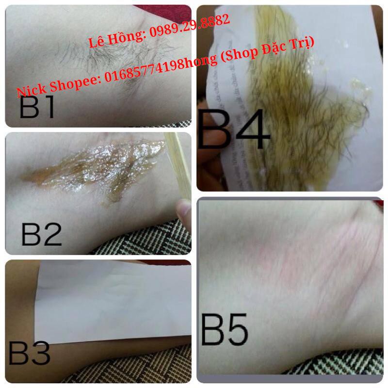 [Chính hãng] Phân loại Combo Triệt Lông Vĩnh Viễn Veo (Mỡ trăn Nguyên chất) (Wax tẩy lông + tặng kèm giấy wax + que gạt)