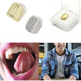 Trang sức dành cho răng mạ vàng độc đáo