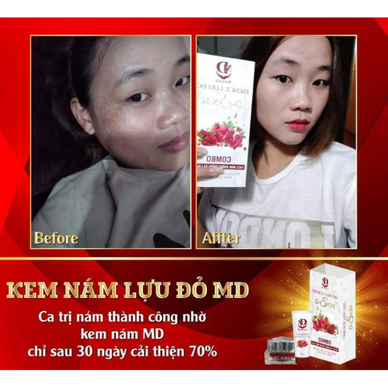 Kem Face Nám Lựu Đỏ MD