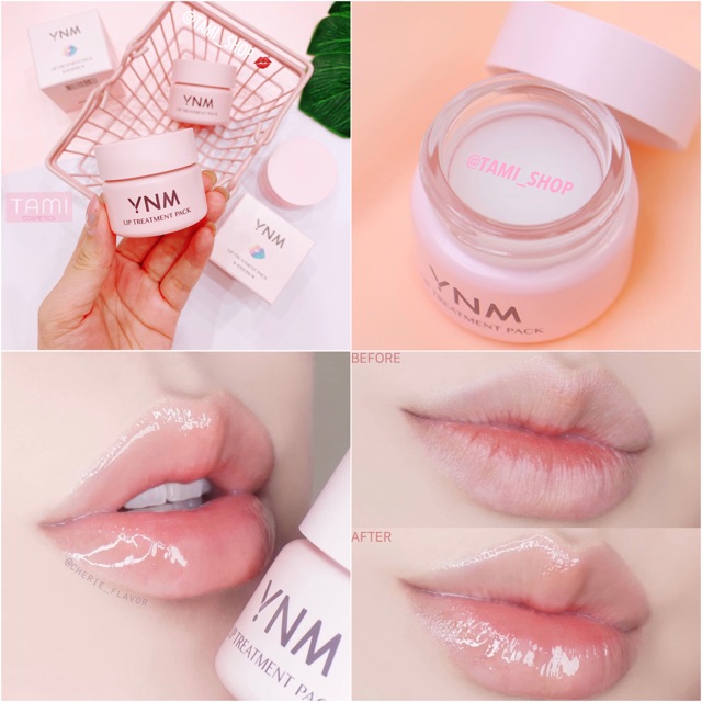 Mặt Nạ Ủ Dưỡng Môi YNM You Need Me Lip Treament Pack (Date T1/2023)