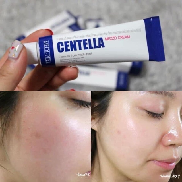 Kem Ngừa Mụn Rau Má Medi-Peel Centella Mezzo Cream - Medi Peel