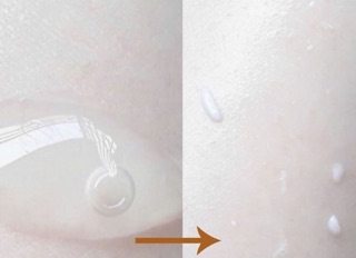 Tẩy tế bào chết Rosette