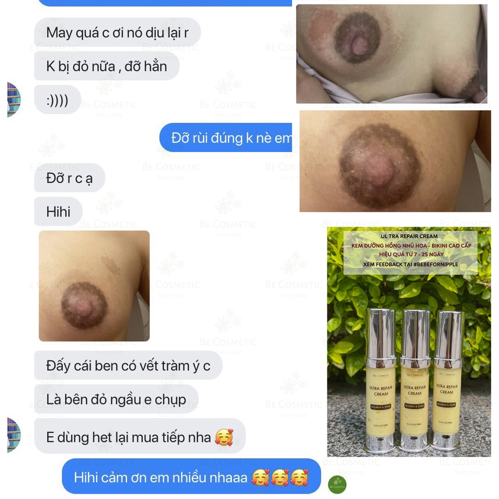 Kem dưỡng hồng nhũ hoa & bikini | BigBuy360 - bigbuy360.vn