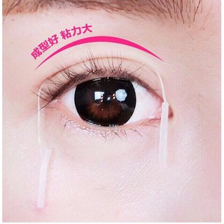 880 Chiếc Kích Mí Cuộn Dạng Lưới - 2 Hộp