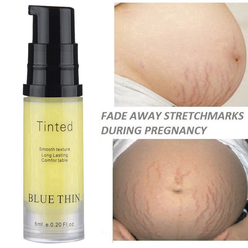 Kem Hỗ trợ giảm sẹo Và Vết Rạn Da 6ml Blue THIN Cao Cấp