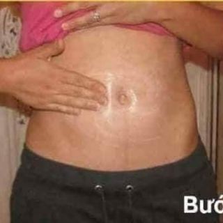 Gel tan mỡ chiết suất gừng quế