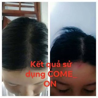 combo tui loc goi dau