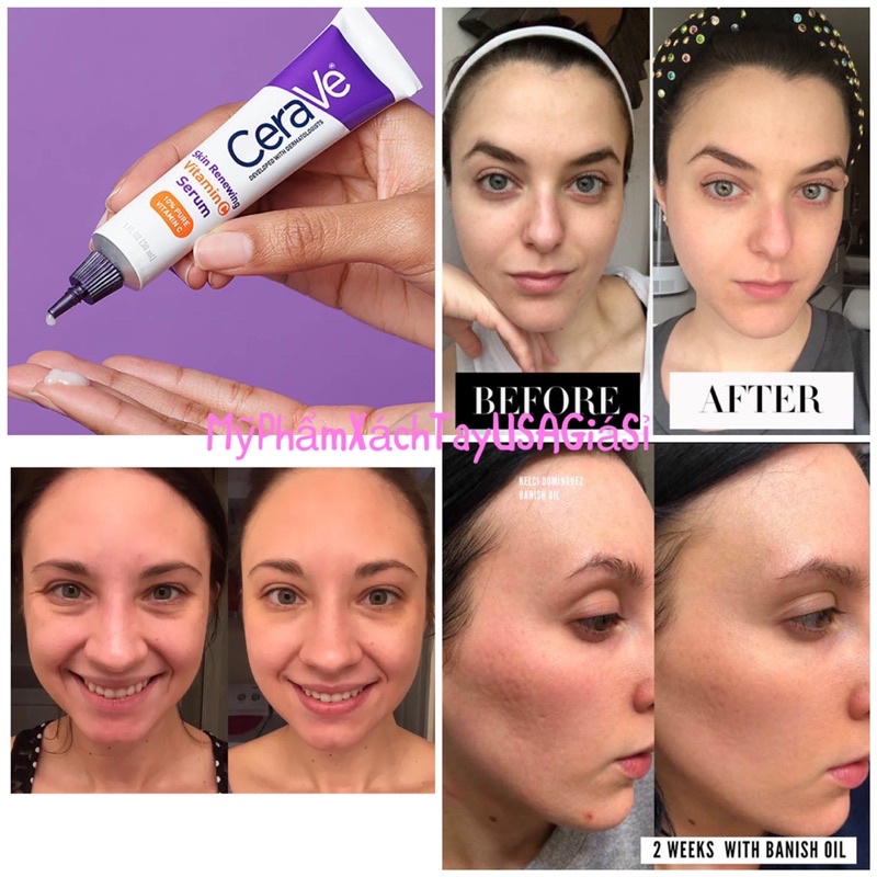 [HàngMỹ] Serum tái tạo sáng da mờ thâm nám Cerave Skin Renewing Viatamin C 30ml