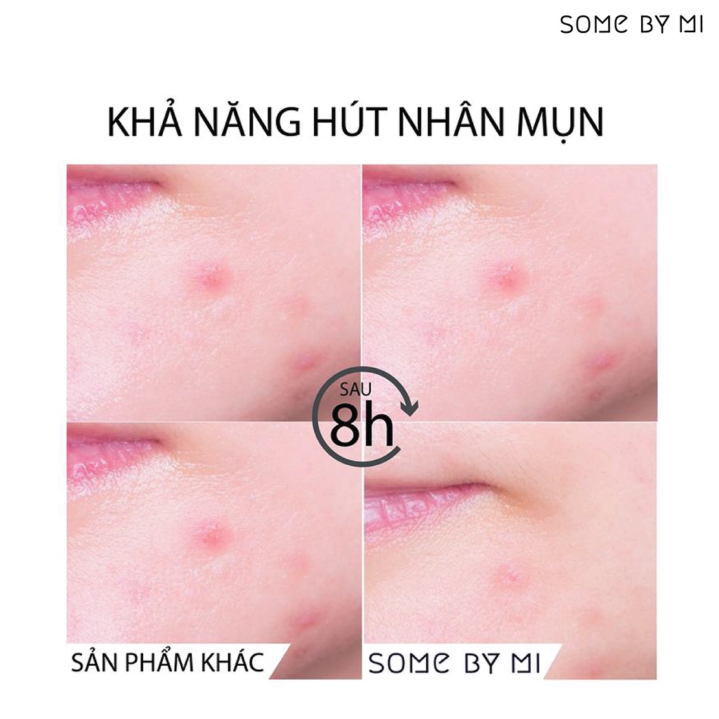 [Nhập Khẩu] Miếng Dán Mụn &quot;Thần Kỳ' Some By Mi Clear Spot Patch