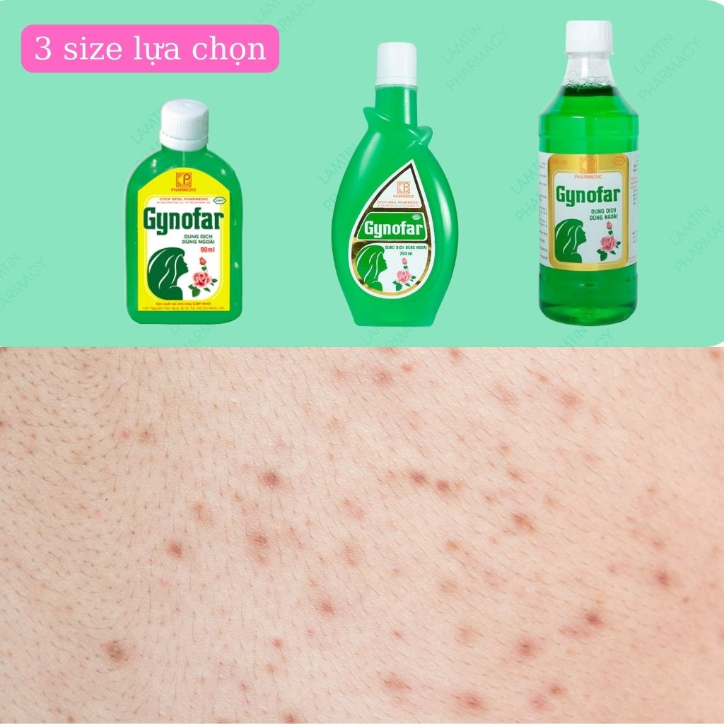 Gynofar Vệ Sinh Phụ Nữ Dung Dịch Dùng Ngoài, Sát Trùng Ngoài Da Chai 90ml, 250ml 500ml, 800ml