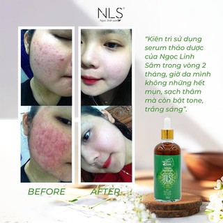 SERUM NGỌC LINH SÂM - BỘT RỬA MẶT [COMBO 2 HỘP]